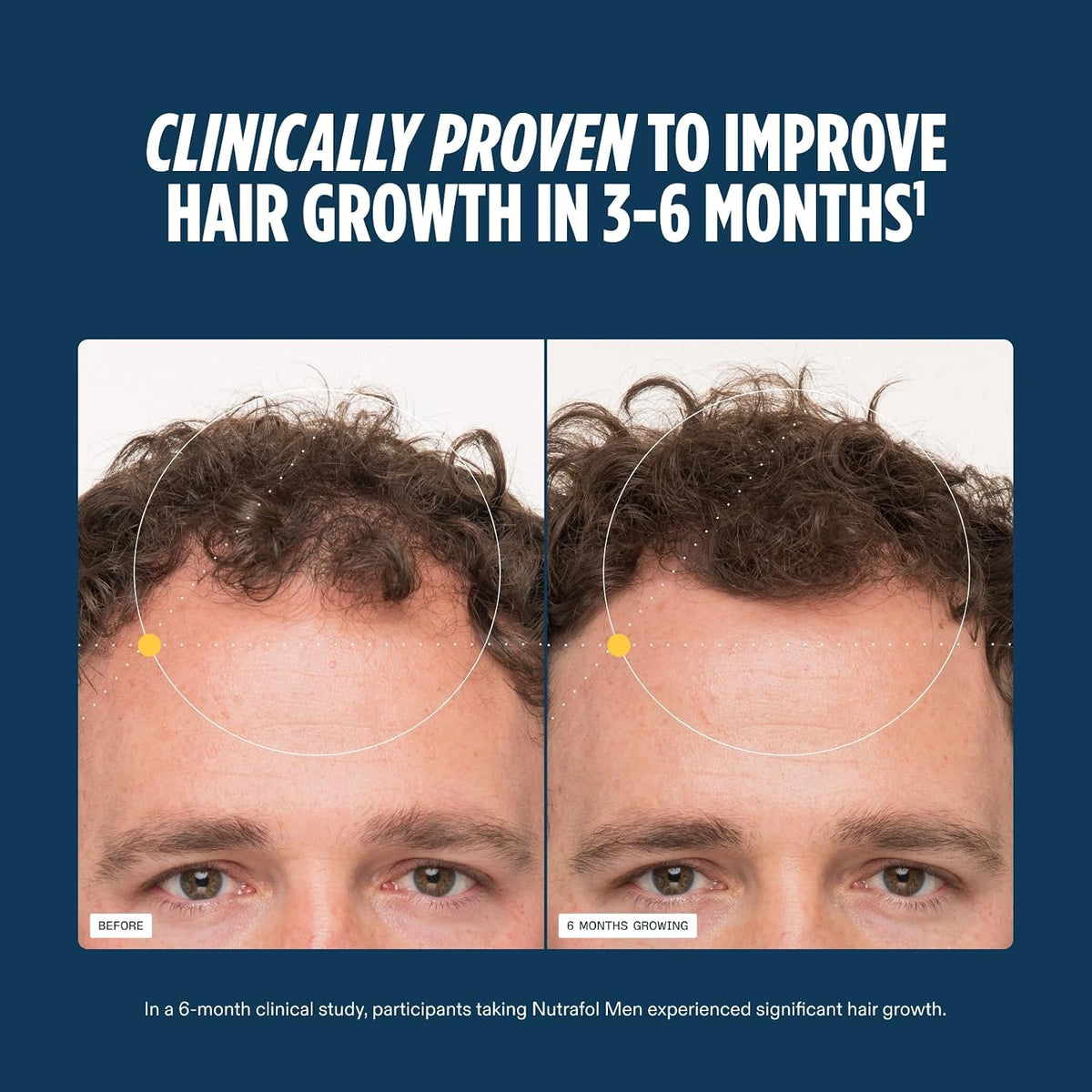 Nutrafol Men hair growth supplement for ages 18–49, with an open bottle, capsules and NSF Certified for Sport testing information. Shop Nutrafol Men Hair Growth Supplements for ages 18–49 at StyleMake India. Delivery in India with import duties included and Cash on Delivery (COD) available.  