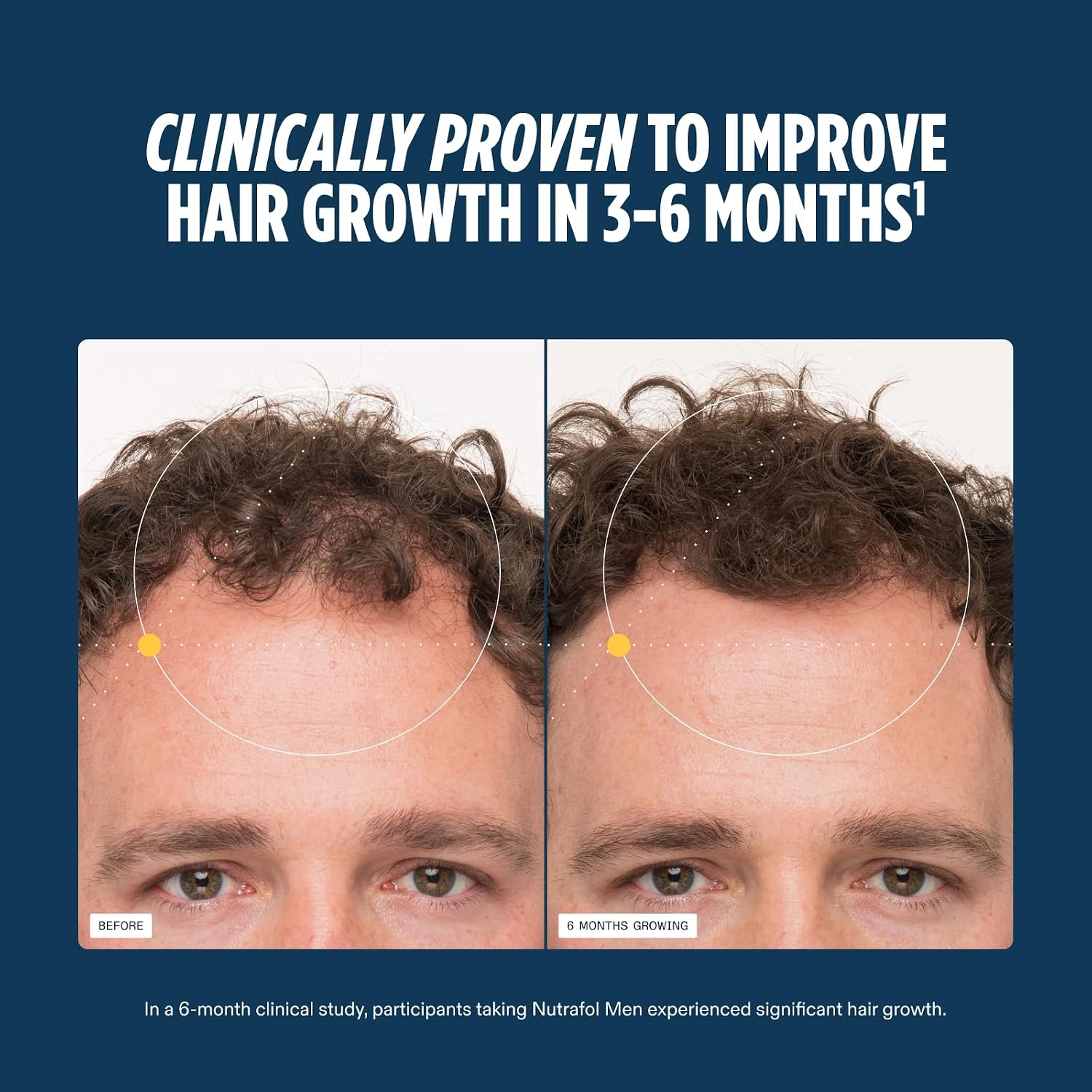 Nutrafol Men hair growth supplement for ages 18–49, with an open bottle, capsules and NSF Certified for Sport testing information. Shop Nutrafol Men Hair Growth Supplements for ages 18–49 at StyleMake India. Delivery in India with import duties included and Cash on Delivery (COD) available.  