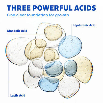 Illustration of three powerful acids labeled Mandelic Acid, Hyaluronic Acid, and Lactic Acid on a white background.